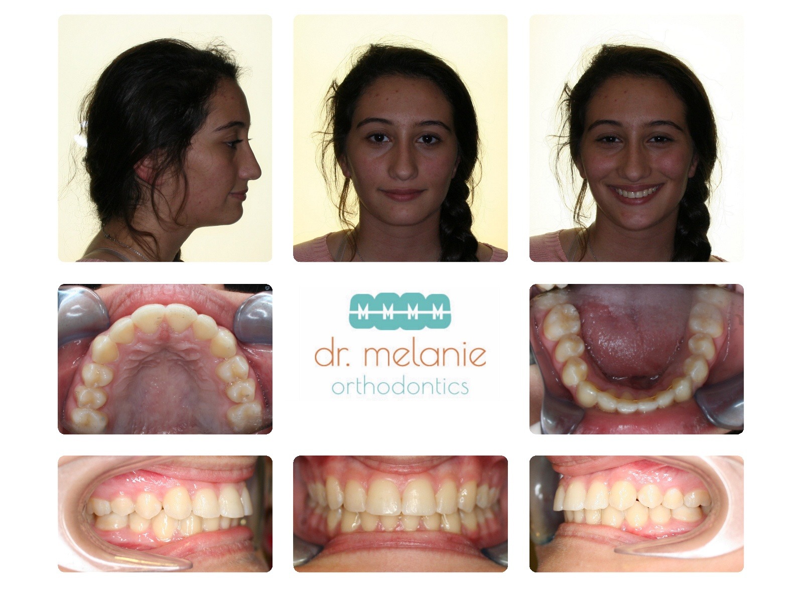 yasmeen after