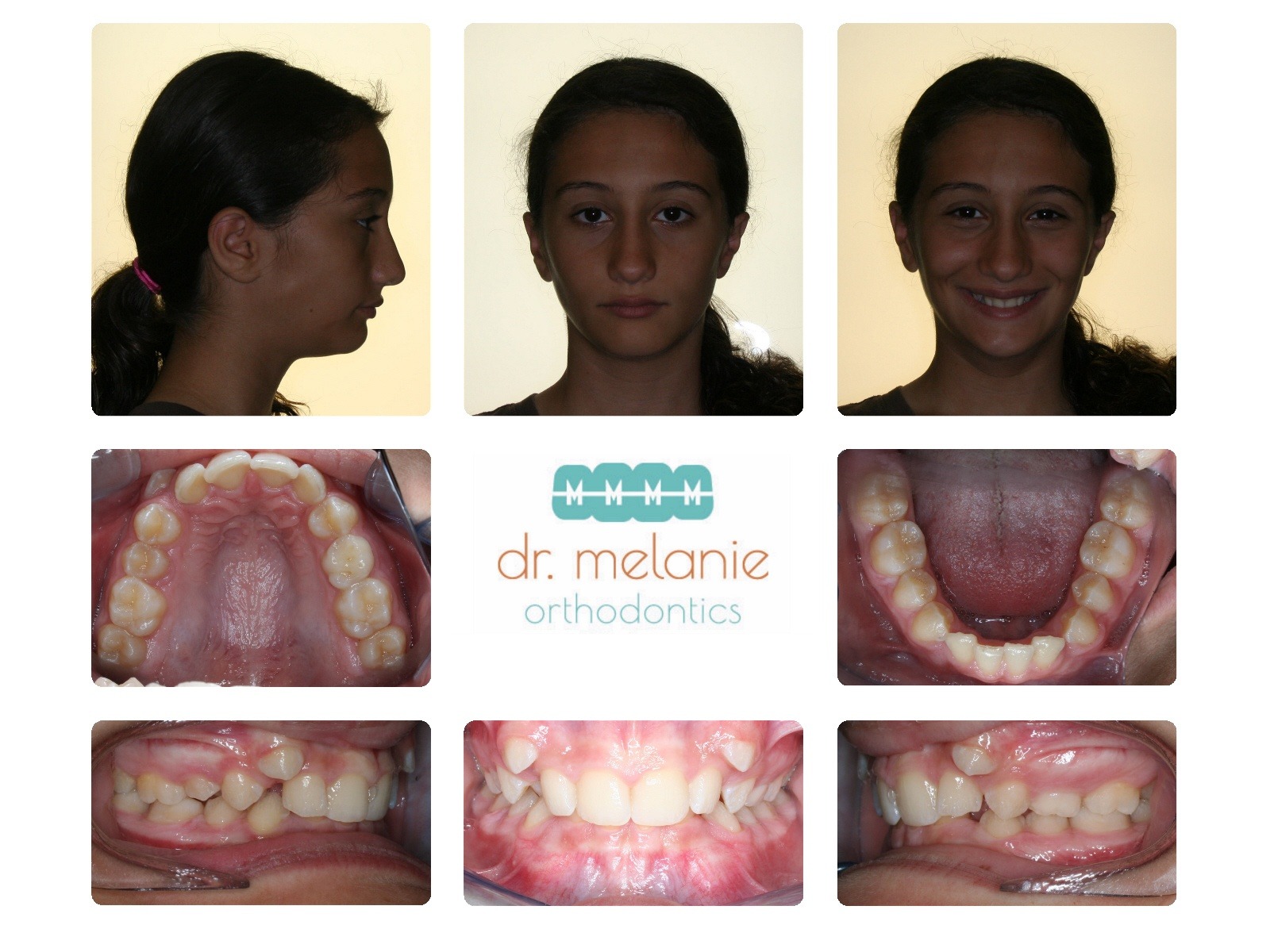 yasmeen before